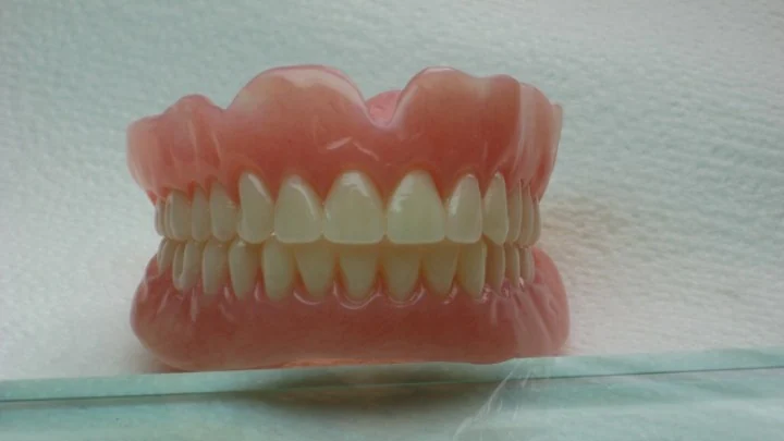 Complete denture restoration displayed in the laboratory